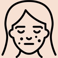 Problémás / pattanásra hajlamos